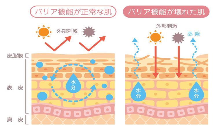 生活を見直すだけで改善される！「肌バリア機能」の低下